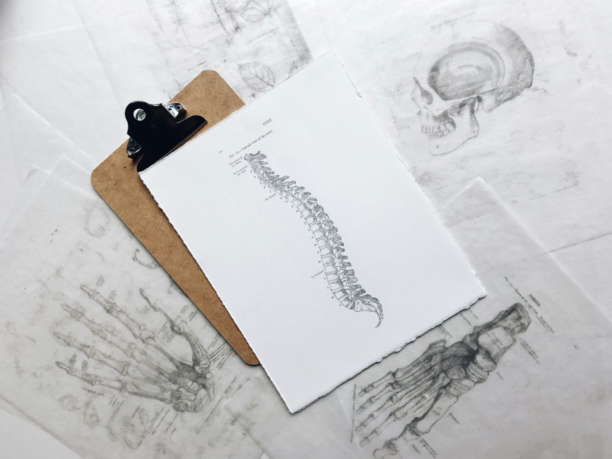 Spinal adjustment diagram at Newton Chiropractic Irving TX